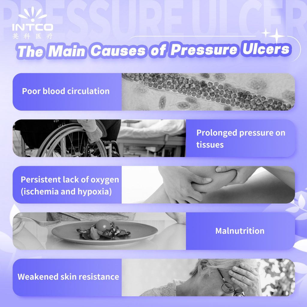 Common Causes of Pressure Ulcers in Wheelchair Users